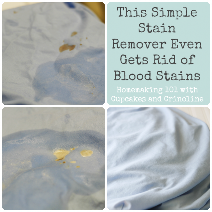 This-Simple-Stain-Remover-Even-Gets-Rid-of-Blood-Stains